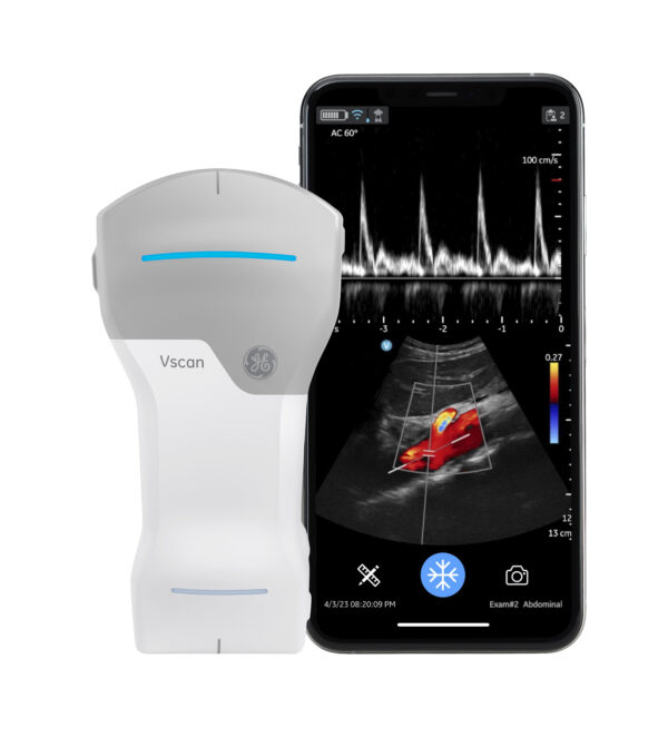 mobiles Farbdoppler Ultraschallgerät Vsacn Air CL mit Handy und Darstellung Aorta mit PW-Mode