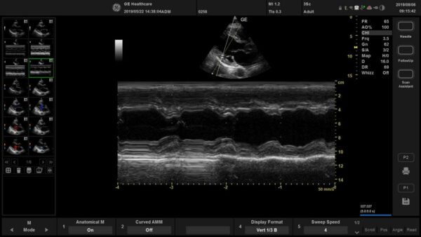 Versana Active Laptop Farbdoppler Ultraschallgerät von GE Healthcare
