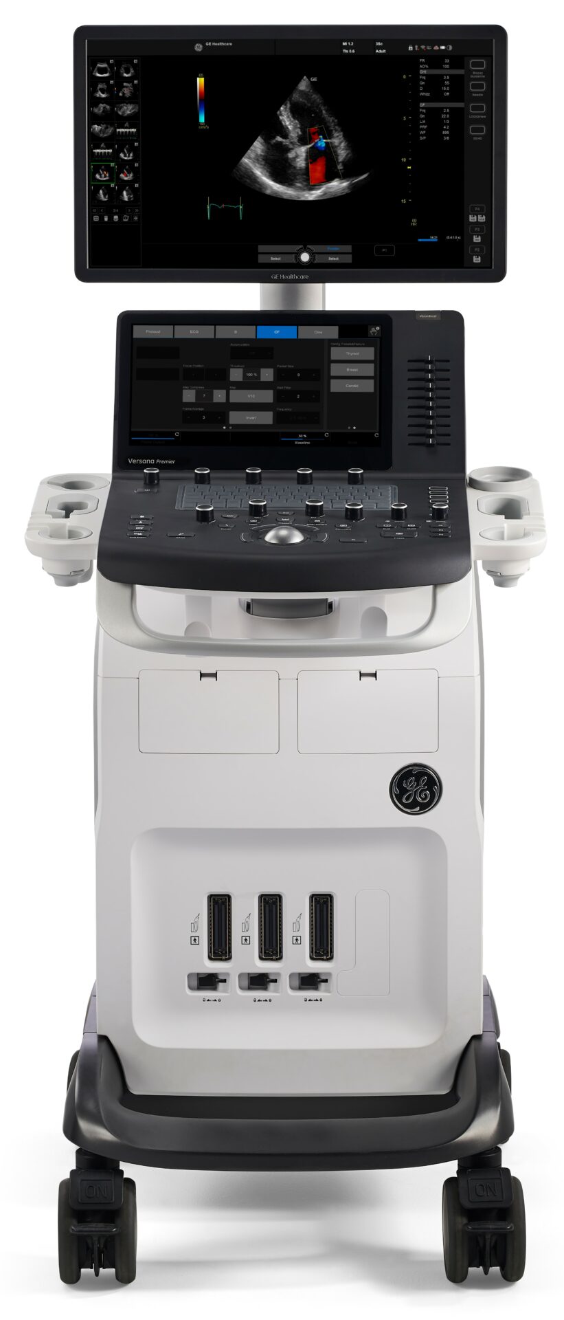 Ultraschallgerät Versana Premier R2 von GE Healthcare