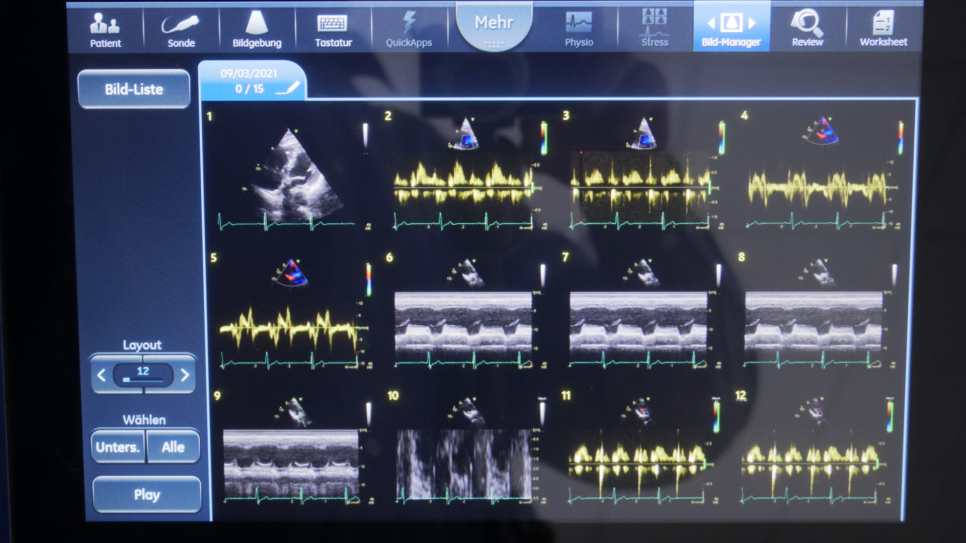 Ultraschallgerät Vivid S60 von GE Healthcare