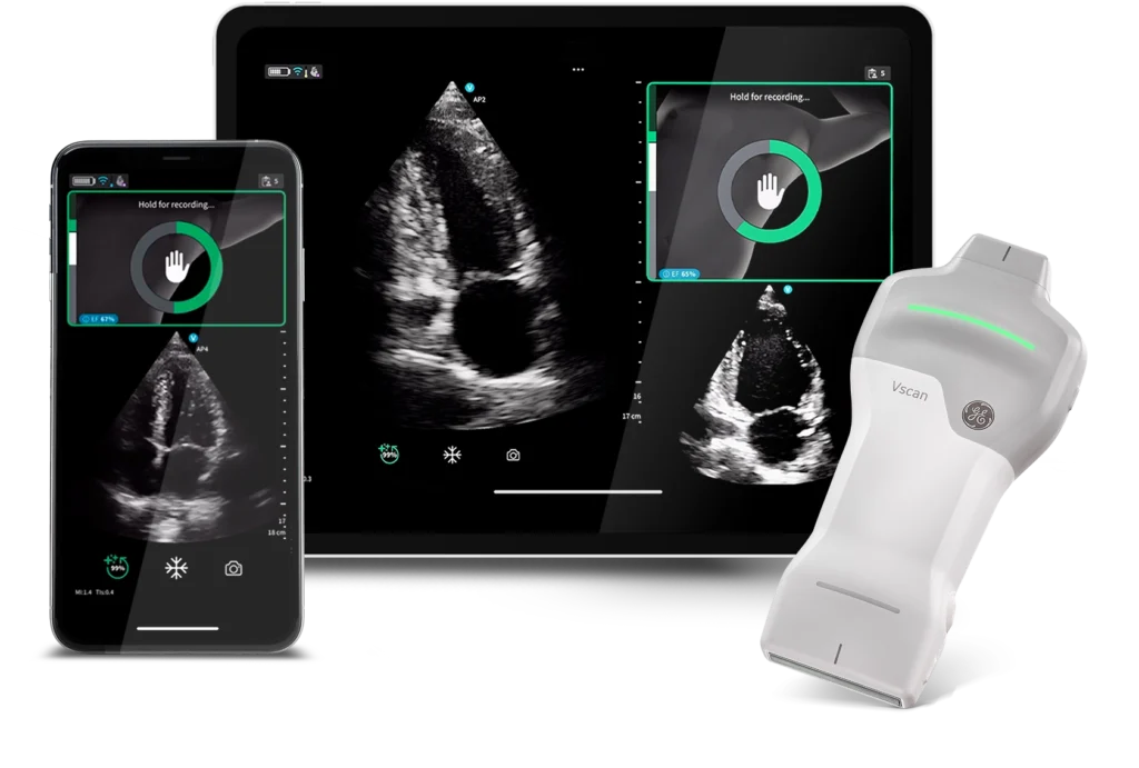 Vscan Air SL mit Caption AI von GE Healthcare