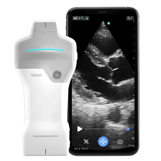 Vscan Air SL von GE Healthcare